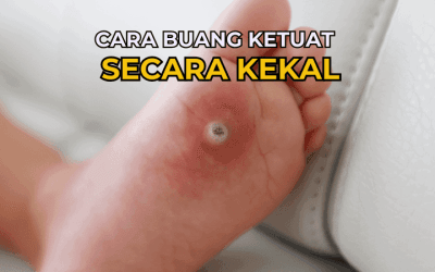 Cara Buang Ketuat Secara Kekal