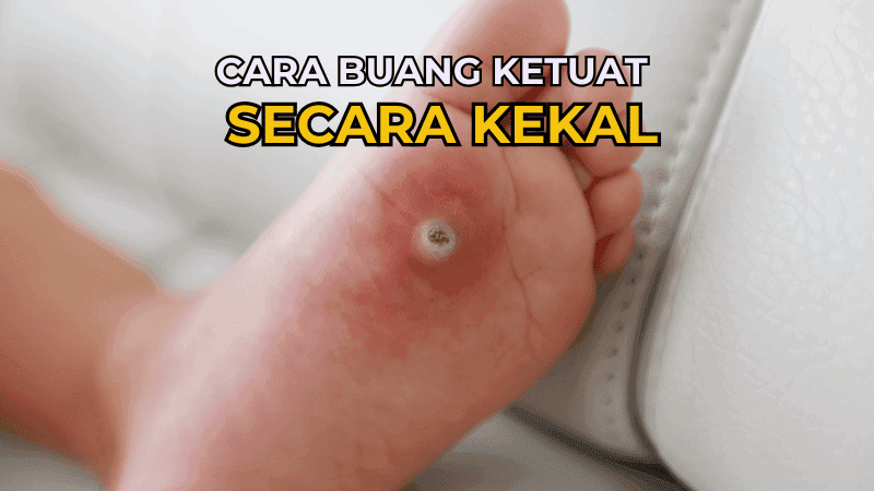 cara buang ketuat