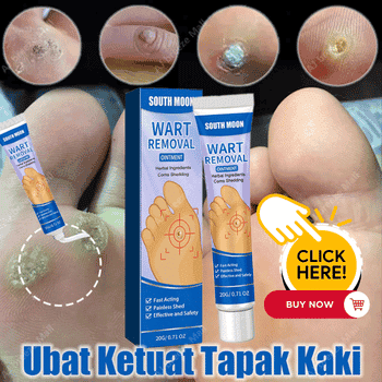 cara buang ketuat