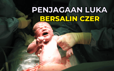Penjagaan Luka Bersalin Czer: Panduan Lengkap Untuk Pemulihan Cepat dan Sihat