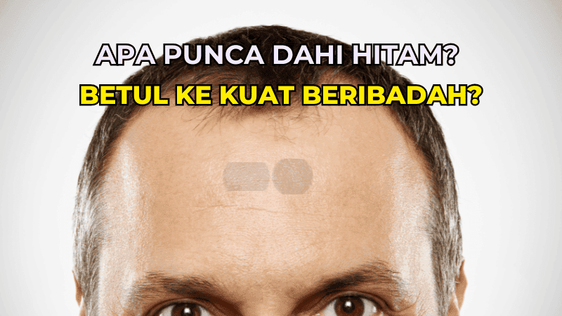 apa punca dahi hitam
