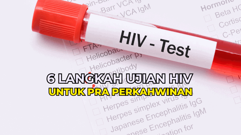 Ujian HIV Untuk Pra Perkahwinan
