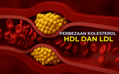 Apa Perbezaan Kolesterol HDL dan LDL?