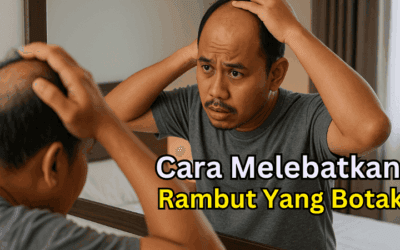 Cara Melebatkan Rambut Yang Botak Secara Semula Jadi: Tip Berkesan Untuk Lelaki Dan Wanita
