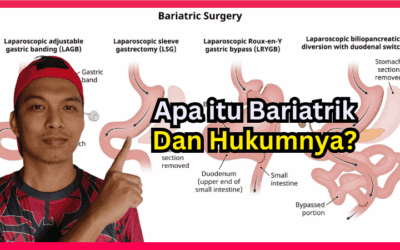 Apa Itu Bariatrik? Ketahui Kelebihan, Risiko, dan Prosesnya