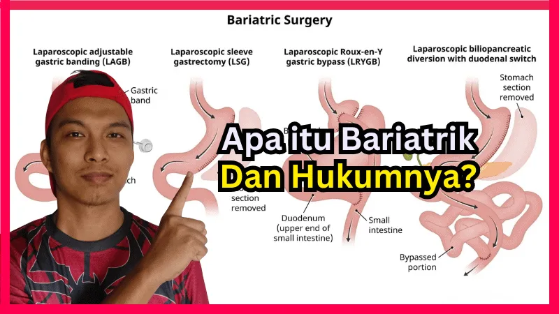 Apa Itu Bariatrik? Ketahui Kelebihan, Risiko, dan Prosesnya